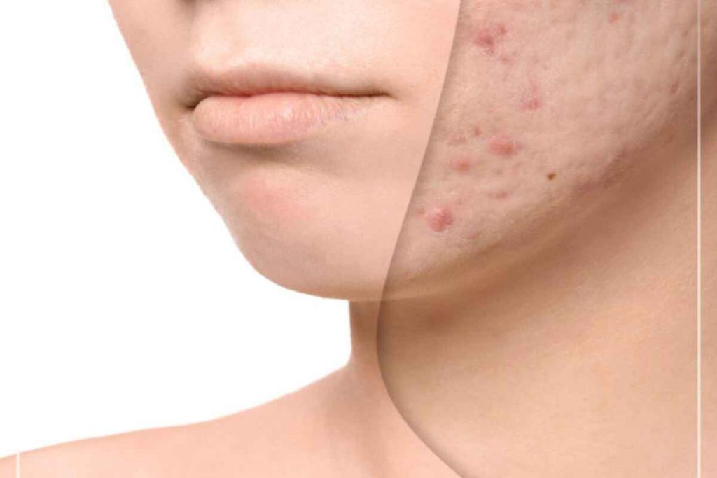 ترمیم کننده